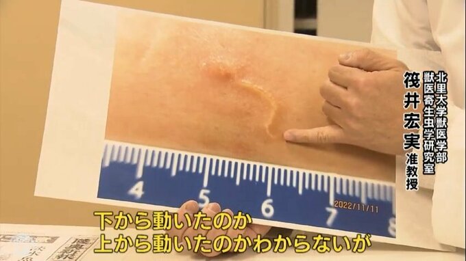 Hàng loạt người bị nhiễm ký sinh trùng do ăn cá bống trắng ở Nhật